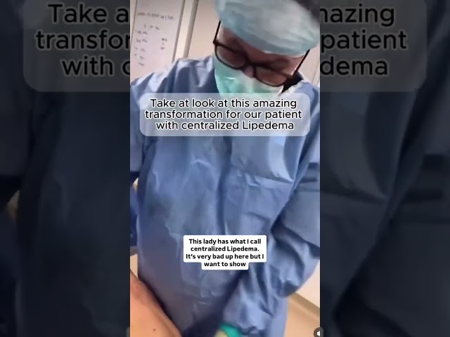 Step inside the OR and see what real Lipedema relief looks like