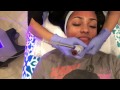 Hydra Facial that helped clear up my ACNE-Brittney Elena