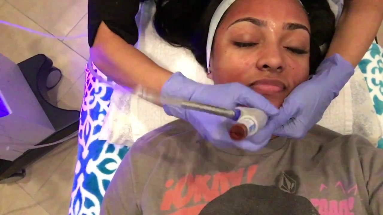 Hydra Facial that helped clear up my ACNEBrittney Elena YouTube