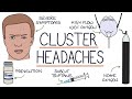 Cluster Headaches