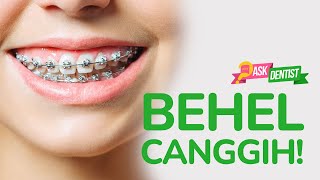 BEHEL INI BENERAN BIKIN GIGI RAPI LEBIH CEPAT #AskDentistFDC