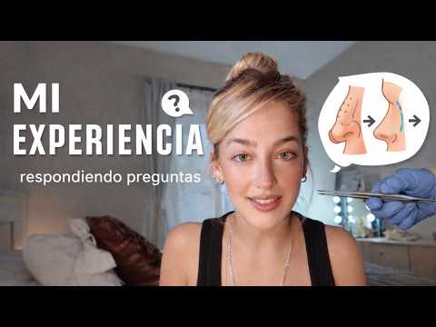 LA VERDAD SOBRE MI RINOPLASTIA (respondiendo preguntas)