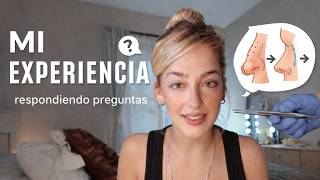 LA VERDAD SOBRE MI RINOPLASTIA (respondiendo preguntas)