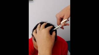 Getting my staples removed from my head. It was more sore than putting it in. Net Worth