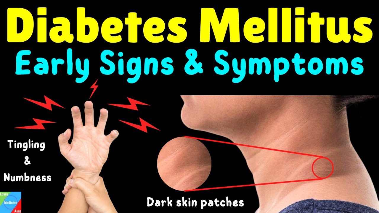 Diabetes Mellitus Signs & Symptoms Early Signs of Diabetes Mellitus