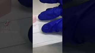 Male infertility | men's health #laboratory #lab #microscope #spermanalysis #sperm #spermmotility