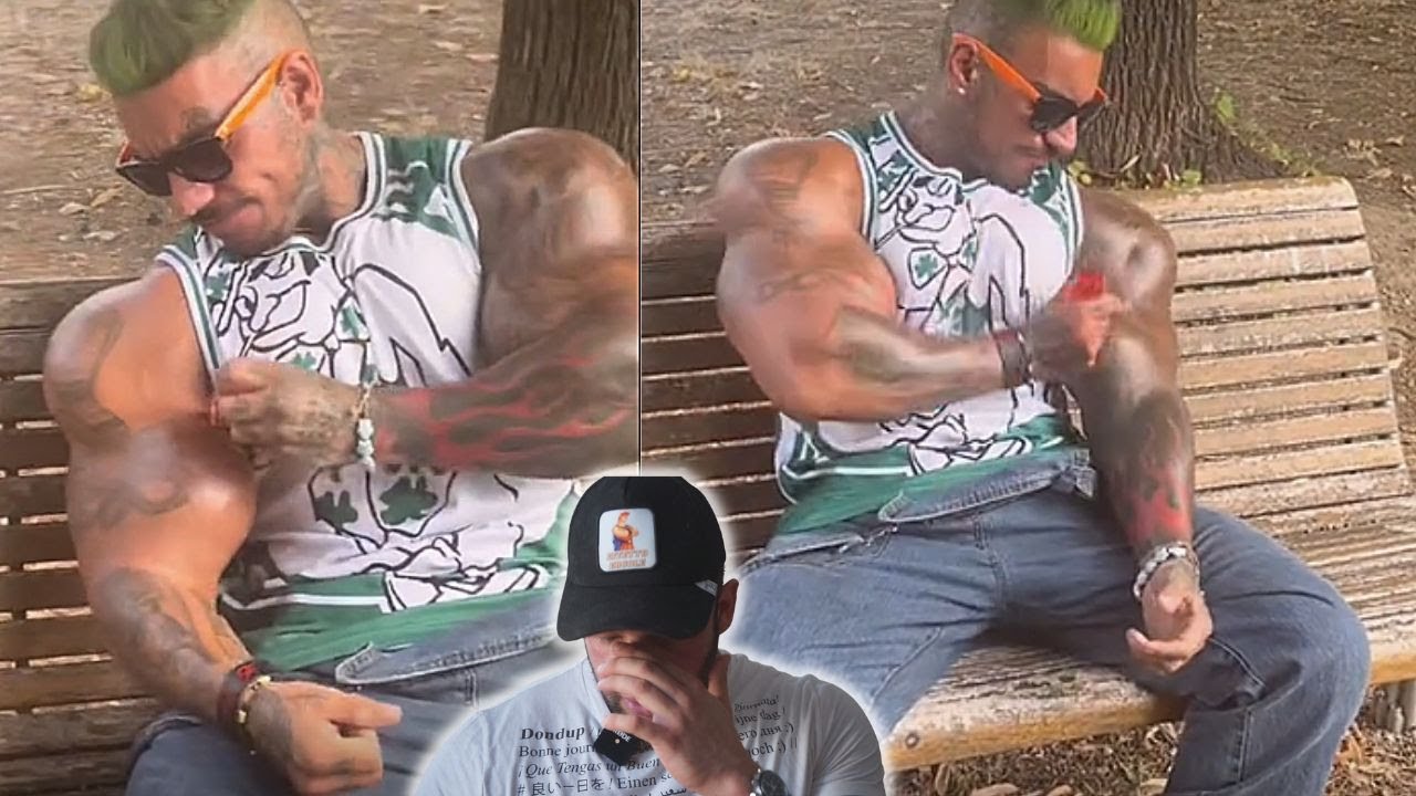 L'Italiano che sta abusando di Synthol (FERMATELO)!