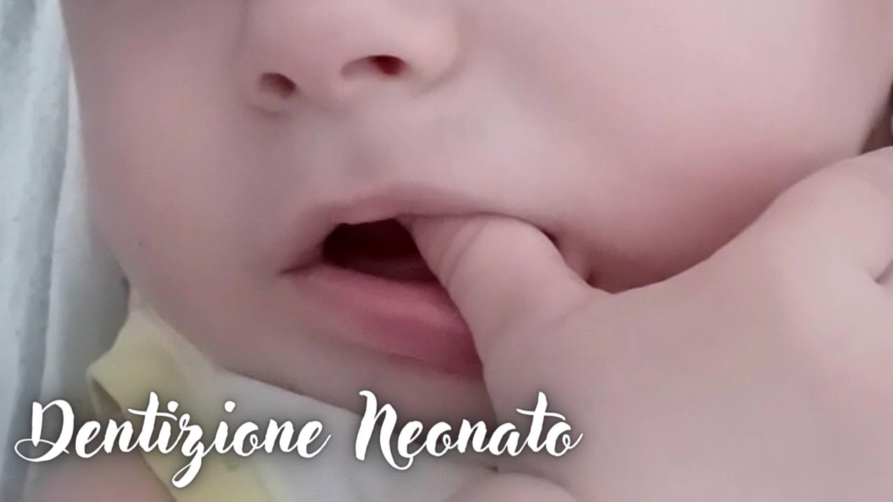 Dentizione Neonato Come Spuntano I Denti Del Bambino Tra Sintomi E  Soluzioni Per Farlo Stare Meglio - YouTube