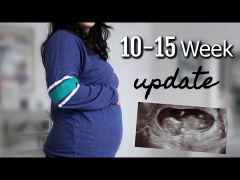 10-15 Week Pregnancy Update- Fetal Doppler Scare, Paranoia, and Ultra Sound - itsMommysLife