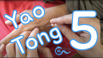 Acupuncture for Low back pain #Theacademyofacupuncture #eileenhan #balancemethodacupuncture