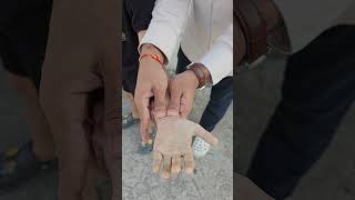 Check your hands blood supply  | Allen Test #allentest #medicine #doctor