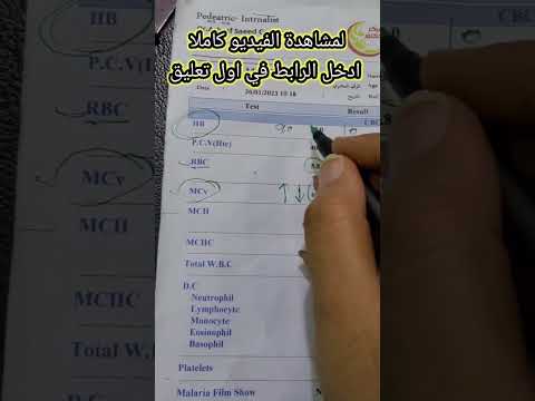 تشخيص نوع فقر الدم من فحص الدم العام 