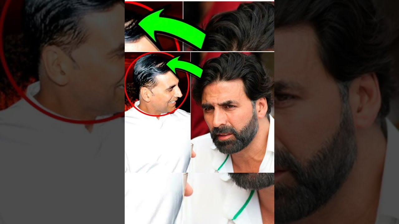 Akshay Kumar baalo ke jhadne se preshan kiya yeh kaam