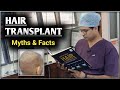5 myths about hair transplant | hair transplant cause cancer | hair transplant cause death #patna