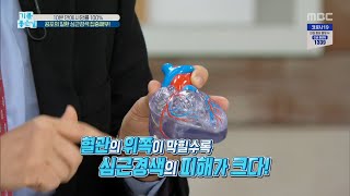 [기분 좋은 날] 공포의 질환 심근경색 집중해부! 20200217