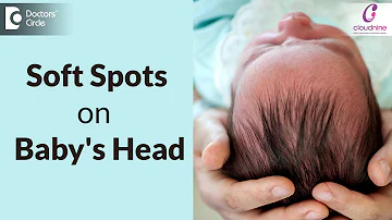 Soft spots on Newborn Baby Head| Fontanelle -Dr.Seema Gaonkar of Cloudnine Hospitals|Doctors' Circle