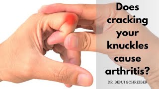 Does Cracking Your Knuckles Cause Arthritis? - Dr. Benji Explains