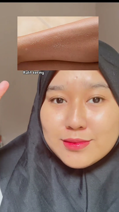 Good Bye to Bruntusan Kulit Kemerahan | Review Autumn Hatomugi Toner