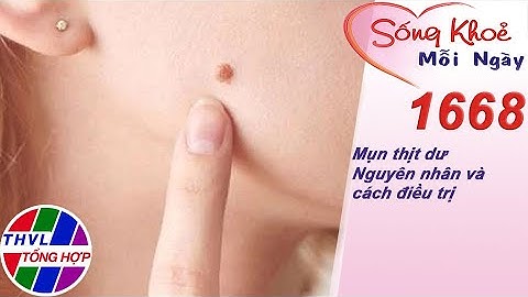 Mụn thịt dư - Nguyên nhân và cách điều trị | Sống khỏe mỗi ngày - Kỳ 1668