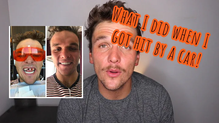 What I did when I was hit by a car on my bicycle...