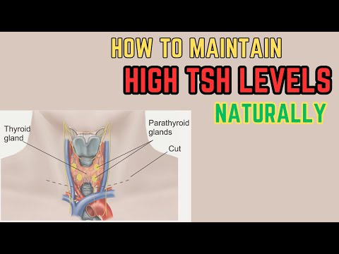 וִידֵאוֹ: כיצד להפחית את רמות TSH: 11 שלבים (עם תמונות)