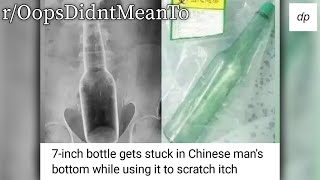 Roopsdidntmeanto What If It Had Broken...