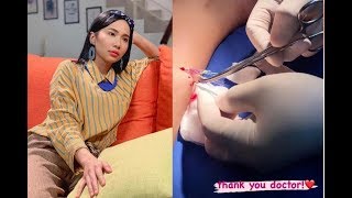 Asyik Memancing, Dayana Roza Tak Perasan Mata Kail Makan Kaki - Mula-Mula Nak Cabut Sendiri Tapi