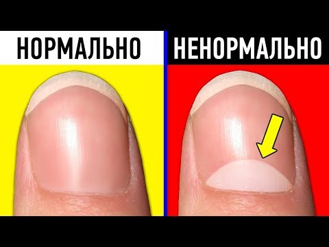 Видео: Признаки, что ты филадельфийский