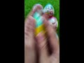 🌟 Opening 150 Eggs… So Many Different Toys 😳🌟