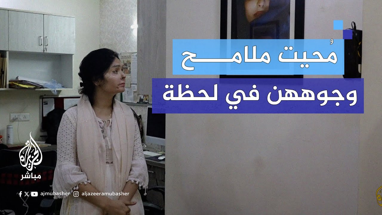عـ.ـنف من نوع آخر.. ناجيات من هجمات الأحماض في #الهند يروين للجزيرة مباشر تفاصيل تعرضهن للاعتداءات
