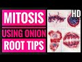Observation of Mitosis in Onion Root tip Experiment | Practical, Procedure