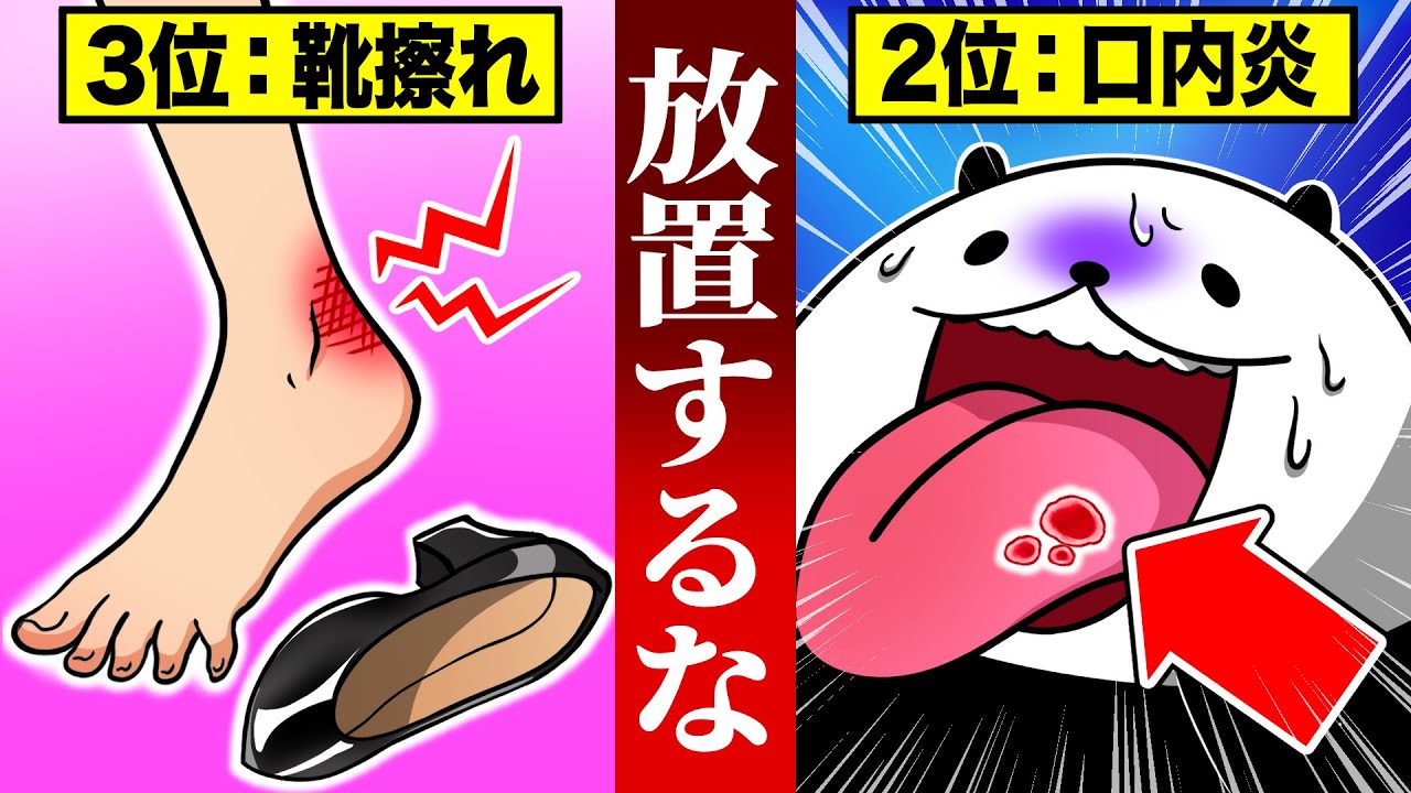 【要注意】放置すると人生終わるケガ5選【アニメ】