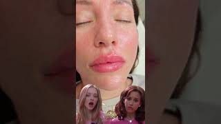 First Time Lips Filler Experience