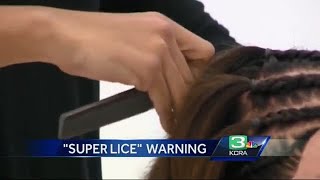'Super lice' spreads throughout U.S.