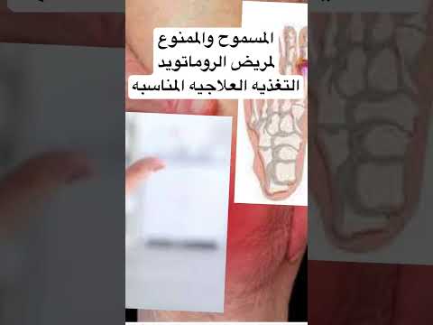 التغذيه العلاجيه لمرضي التهاب المفاصل الروماتويدي الروماتويد