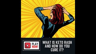 What is Keto Rash and How do you Cure it?