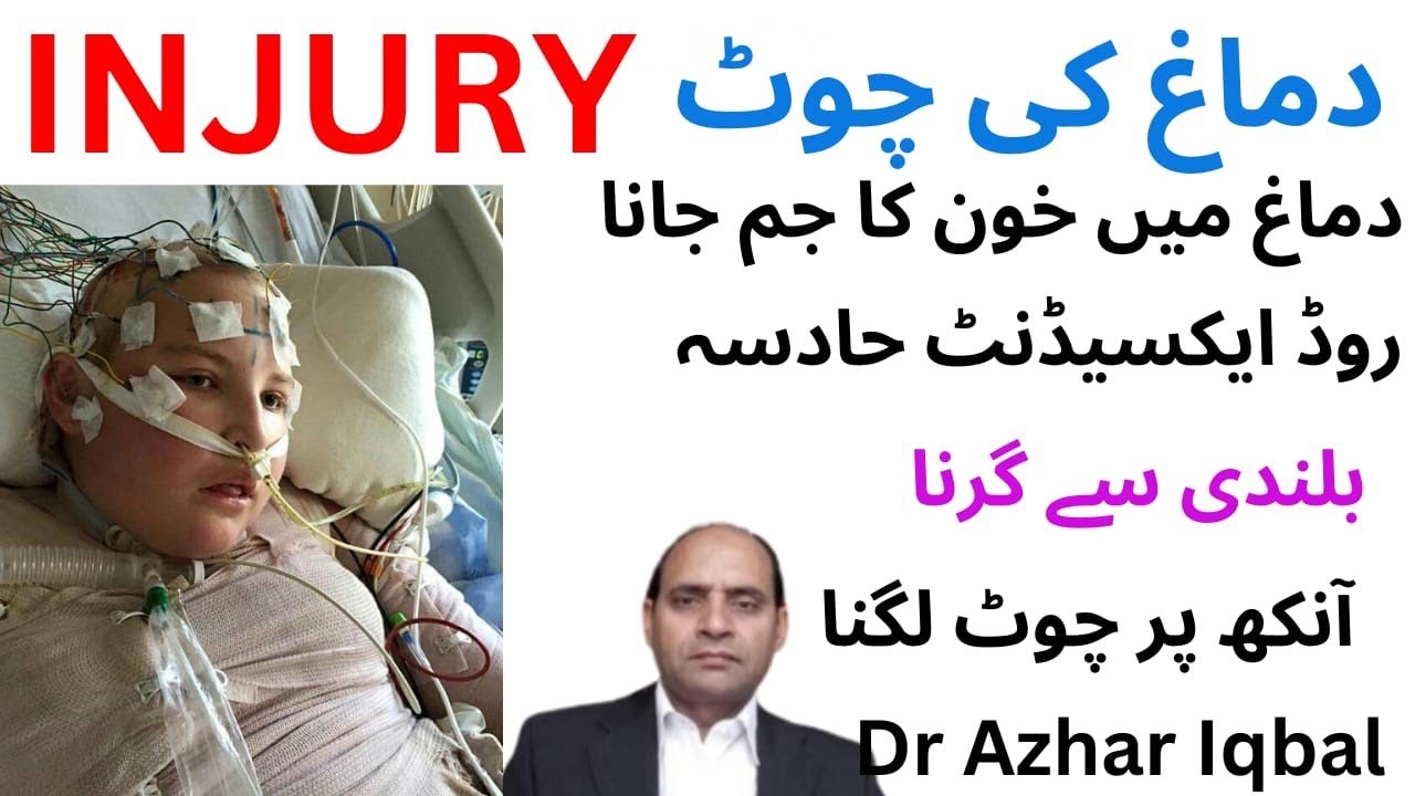 ROAD ACCIDENT,BRAIN INJURY TREARMENTसड़क दुर्घटना, मस्तिष्क की चोट का