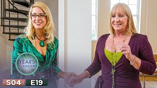 Viv Reveals Her New Face After Five Hours of Surgery! | 10 Years Younger UK Season 4 Episode 19