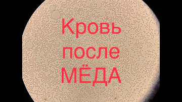 Кровь после мёда
