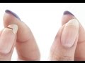 Cum sa repari o unghie rupta