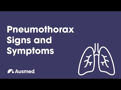 Pneumothorax: Signs and Symptoms | Ausmed Explains...