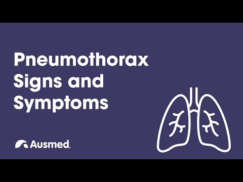 Video: Flyreiser Og Forekomst Av Pneumothorax Ved Lymfioioleiomyomatose