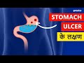 Peptic ulcer kya hai | Peptic Ulcer Symptoms and Diagnosis in Hindi || Practo