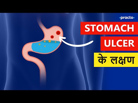 Peptic ulcer kya hai | Peptic Ulcer Symptoms and Diagnosis in Hindi || Practo