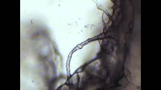 DNA under microscope