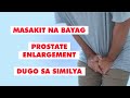 Q & A | MASAKIT NA PUSON, PROSTATE ENLARGEMENT, MASAKIT NA BAYAG, DUGO SA SIMILYA ATBP.