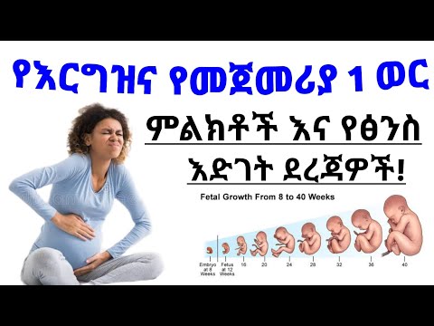 ቪዲዮ: የጠፈር ወደቦች አያስፈልጉም: የስበት ኃይልን ማፋጠን መለወጥ