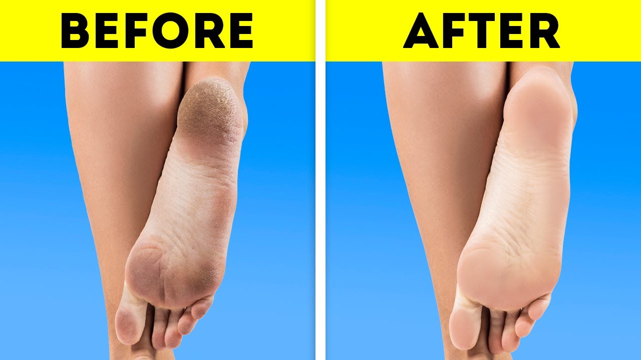 IT’S ALL ABOUT BEAUTY OF YOUR FEET || Fast Feet Transformation - YouTube