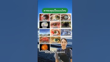 ตาไหนที่ตรงกับตาของคุณ #หมออุ๊ย #goodeyes #จักษุแพทย์ #โรคตา #ดวงตา #ต้อหิน #ต้อลม #ต้อกระจก