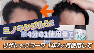 ミノキシジル5% リザレックコーワを4分の1の量で使用して1年2ヶ月〜プレマ家の買物
